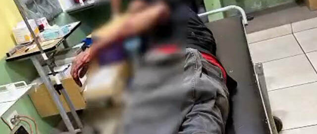 Apóstoles: un hombre fue herido con un machete tras una discusión y el agresor fue detenido